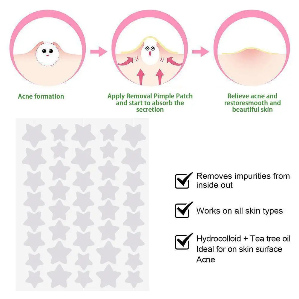 40Pcs/sheet Colorful Cute Star Heart Shaped Treatment Sticker Invisible Cover Removal Pimple Patch Skin Care